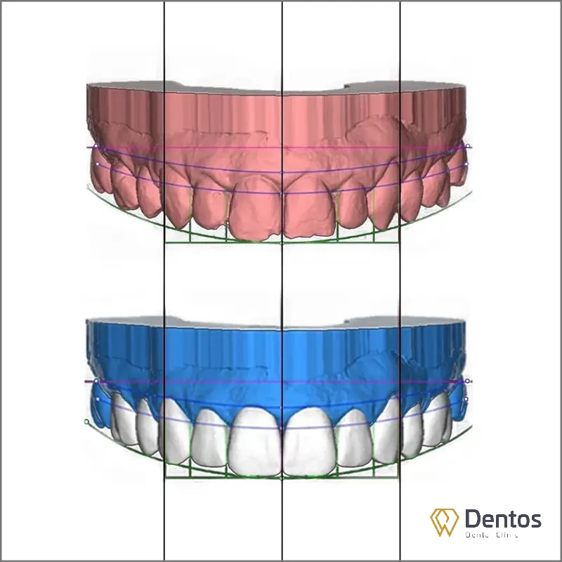Công nghệ DSD 3D thiết kế nụ cười phù hợp với từng người